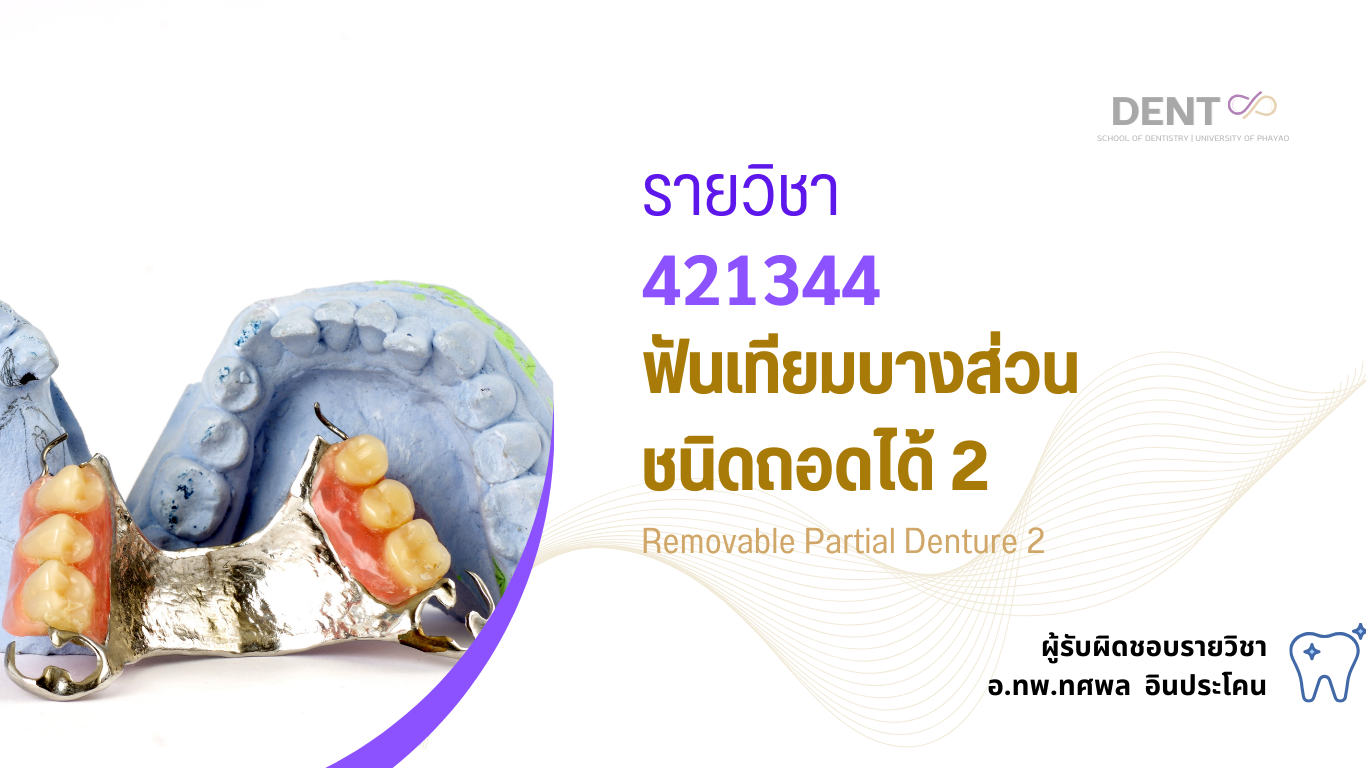 421344[1] - ฟันเทียมบางส่วนชนิดถอดได้ 2 (2/2567)